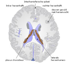 hersenvocht