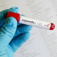 Hersenletsel dankzij de legionella bacterie